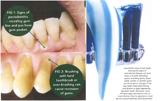 Feeling glum about gum disease?